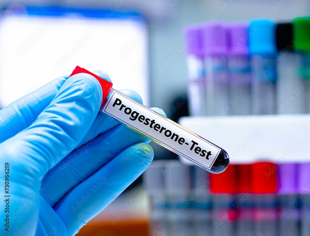 Blood sampling tube for progesterone test analysis. Blood sampling tube for progesterone test analysis.