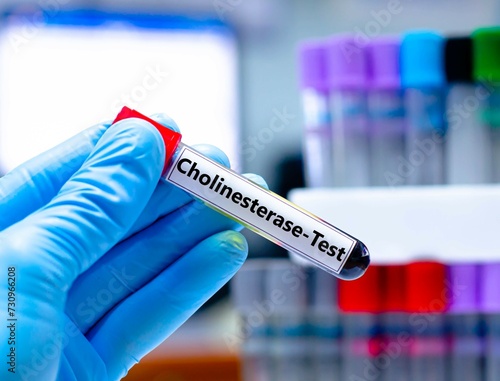 Blood sampling tube for cholinesterase test analysis. photo