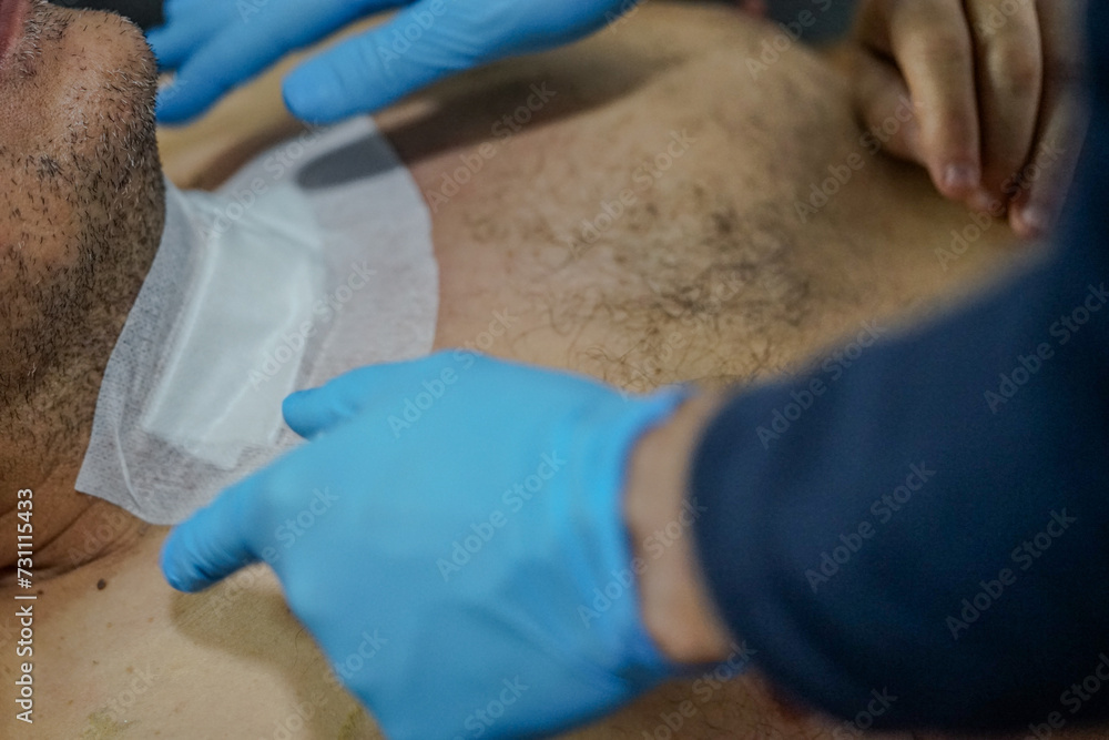 The wound from the thyroid operation is healed and covered for protection and recovery with gauze and adhesive strips The wound from the thyroid operation is healed and covered for protection and recovery with gauze and adhesive strips