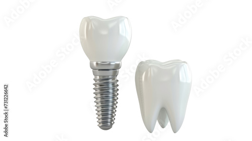 Tooth and dental implant isolated on transparent background