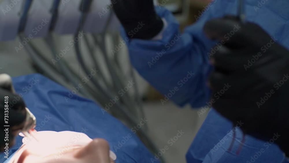 Close-up. surgeon's hands, black gloves, perform operation remove impacted wisdom tooth together assistant, nurse. Saliva ejector blood. Surgical suit, uniform. wound mouth sutured clamp. Sleep Close-up. surgeon's hands, black gloves, perform operation remove impacted wisdom tooth together assistant, nurse. Saliva ejector blood. Surgical suit, uniform. wound mouth sutured clamp. Sleep
