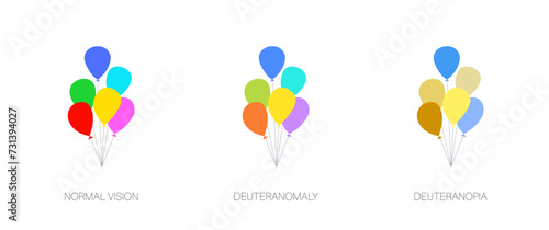 Deuteranomaly and deuteranopia