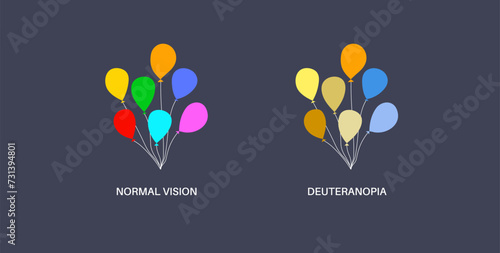 Deuteranomaly and deuteranopia
