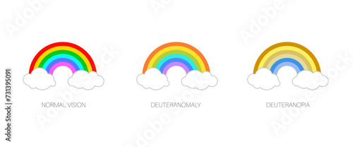 Deuteranomaly and deuteranopia