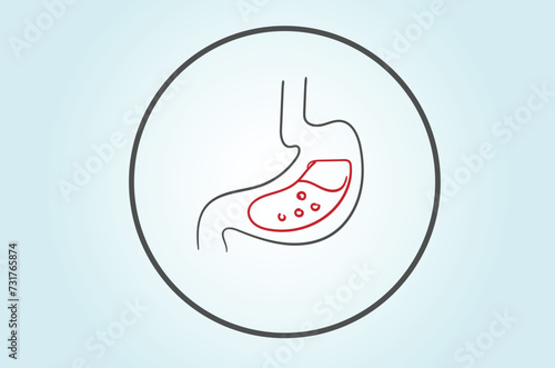 Gastroenterologists perform a wide range of endoscopic procedures to diagnose and treat gastrointestinal conditions