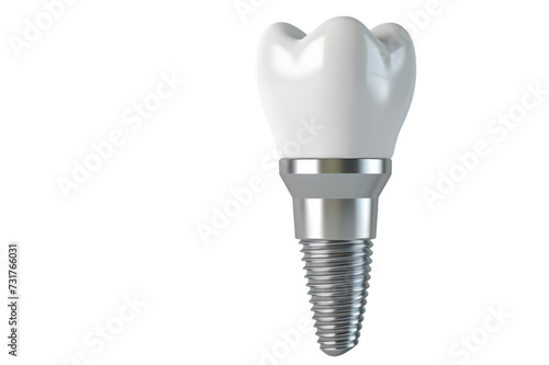 Implant isolated on transparent background photo