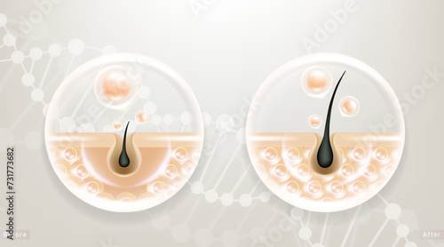 Hyaluronic acid before and after hair and skin solutions ad. white collagen serum drop into skin cells with cosmetic advertising background ready to use, illustration vector.