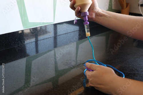 Bild auf Leinwand Woman holding the enteral nutrition bottle and infusion set in the kitchen