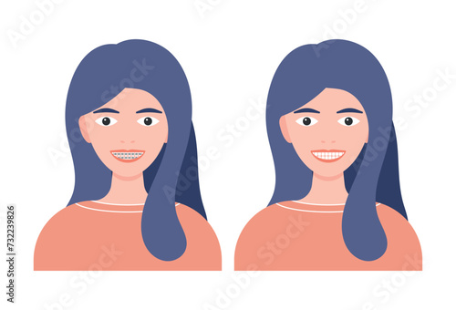 Woman with braces on her teeth vector illustration