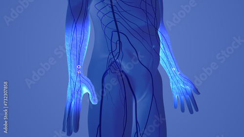 Φωτογραφία Hand numbness and Tingling Carpal Tunnel