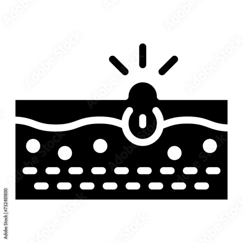 Blackhead icon vector image. Can be used for Cosmetology.