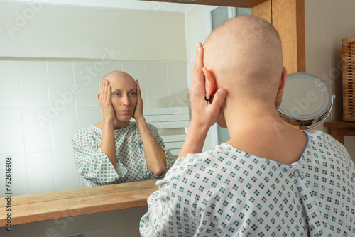 Sad patient woman gazes at hair loss in her mirror reflection