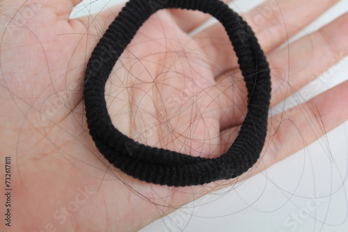 A black hair ties with strands of black hair, on a female hand palm. Hair loss or hair falling out or hair breakage