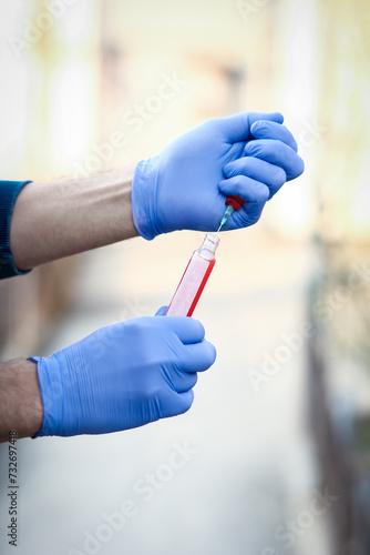 In the hands of a test tube with blood for analysis of the virus. Covid-19 is a danger to the infectious air population.
