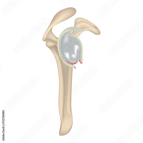 Clavicular joint. labrum injury. Realistic rendering of the collarbone. Medical design. Vector illustration.