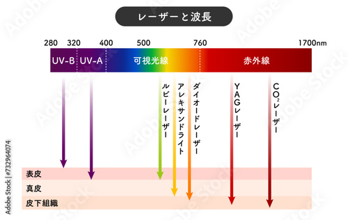 レーザー治療　波長　ルビーレーザー　CO2レーザー　アレキサンドライト　しみ　美容医療　種類　パルス幅