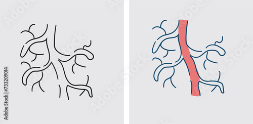 Jobs or activities that require long periods of standing or sitting may hinder proper blood flow in the legs, contributing to the development of varicose veins photo