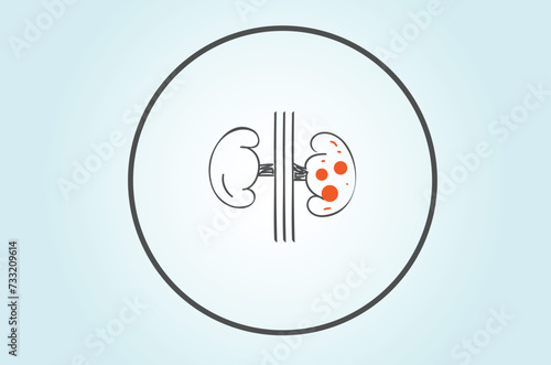 Treatment options for kidney stones depend on factors such as the size and location of the stones, as well as the severity of symptoms