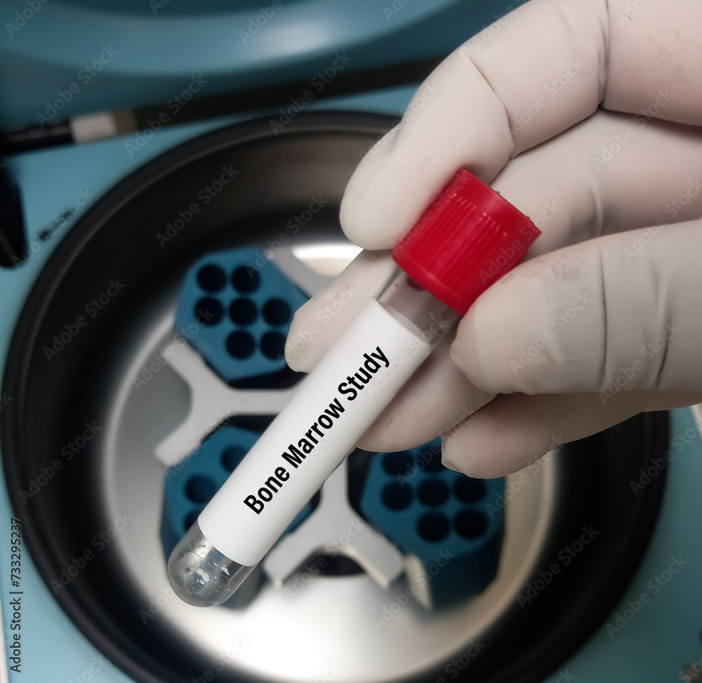 Bone marrow study. Scientist preparing bone marrow samples for flow ...