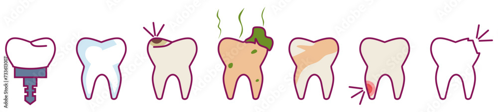 Dental Procedure Silhouette Icon Set. Orthodontic Care, Tooth with ...