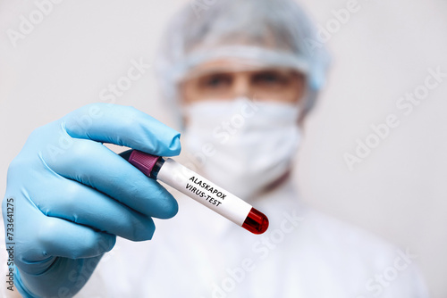 A medical worker holds a test tube with Alaskapox virus infected blood sample in his hands,hands in gloves close-up.Epidemic of alaskapox in the USA. photo