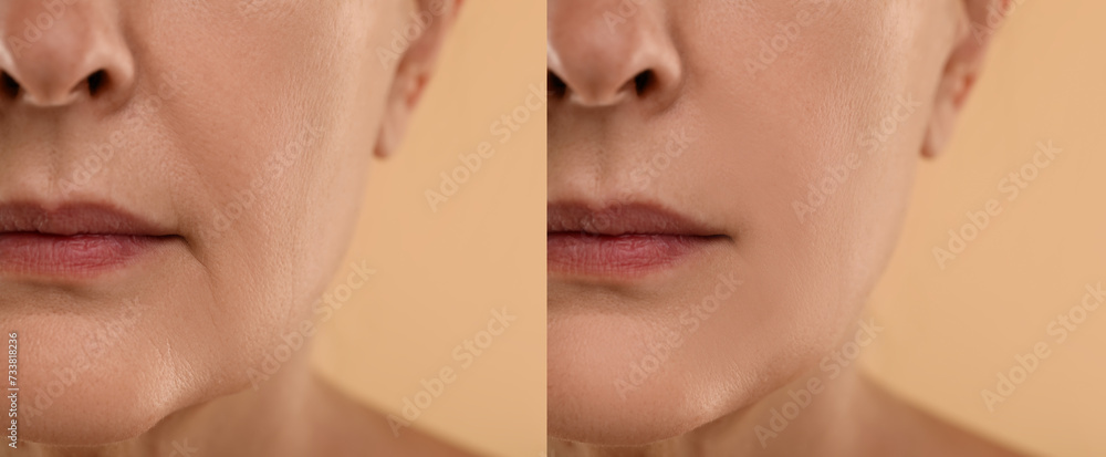 Obraz premium Aging skin changes. Woman showing face before and after rejuvenation, closeup. Collage comparing skin condition