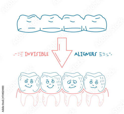 Orthodontic silicone trainer. Invisible braces aligner, retainer.