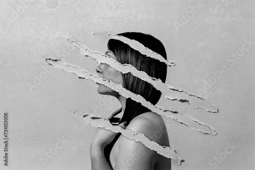 Scars