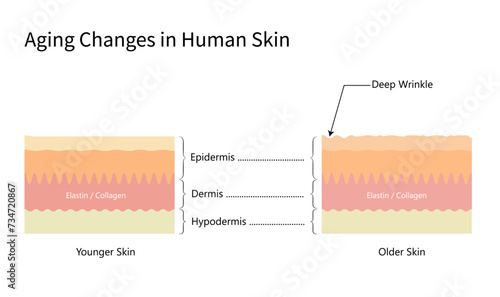 Aging Changes in Younger,older skin.anatomy, collagen,elastin.  Visual of skin changes,lifetime. structure of the dermis,Vector diagram, illustrations, isolated white, horizontal, free space,compare 