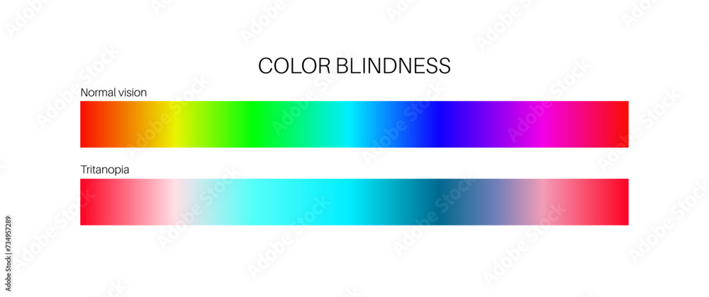 Fototapeta premium Tritanopia and tritanomaly