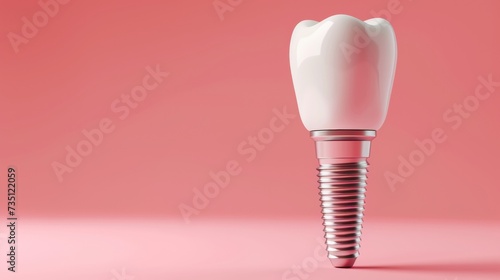 Dental Implant on Pink Background