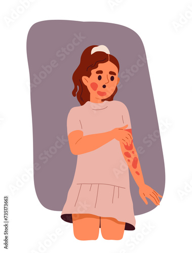 Person with skin disease. Girl with red spots at skin. Dermatological problems and illness. Template and layout. Cartoon flat vector illustration isolated on white background