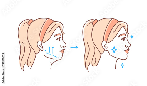 Plastic surgery face doodle. Beauty treatment and skin care. Woman with antiaging procedures. Graphic element for website. Linear flat vector illustration isolated on white background