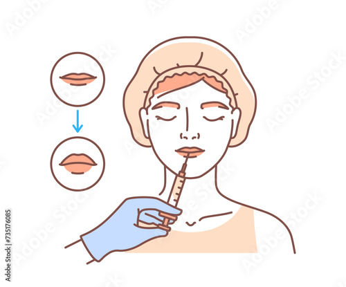 Plastic surgery face doodle. Woman with antiaging procedures. Beauty treatment and skin care. Girl with injection in lips. Linear flat vector illustration isolated on white background