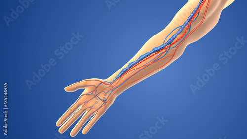 Cuadro en lienzo Medical animation of the Arteriovenous fistula