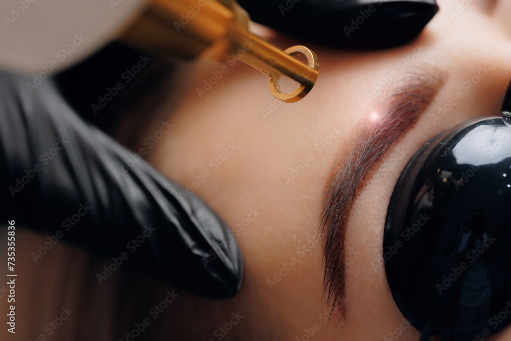 Φωτογραφία Laser removal of tattoo permanent makeup eyebrow of young woman in salon