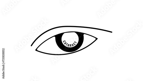 cataract symbol , black isolated silhouette