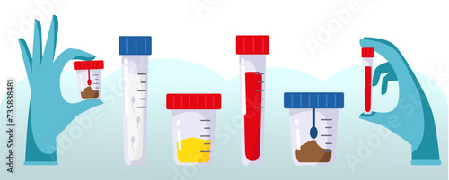Set up the test tubes. Blood, urine, feces, spermogram. hands in medical gloves Medical equipment. Sample analysis. Plastic containers with biomaterial. Laboratory analysis. Flat design vector images.