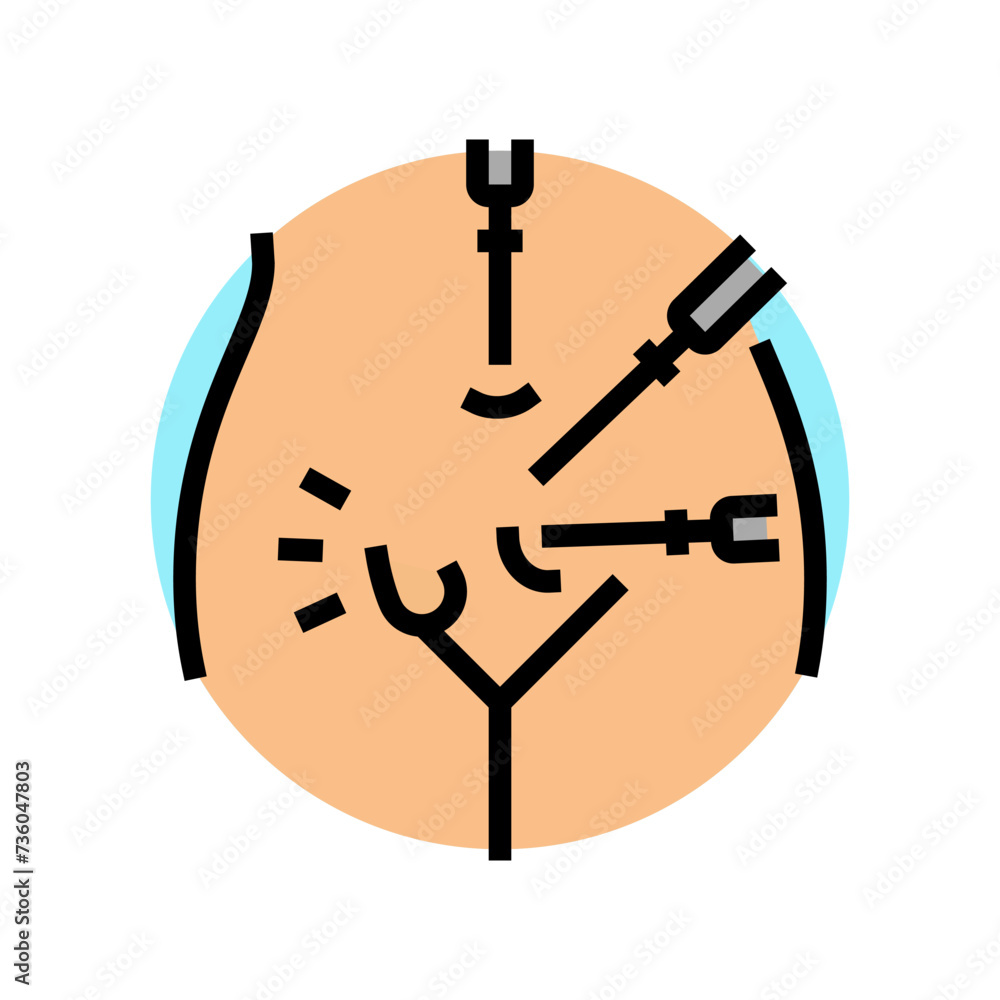 inguinal hernia repair surgery color icon vector. inguinal hernia