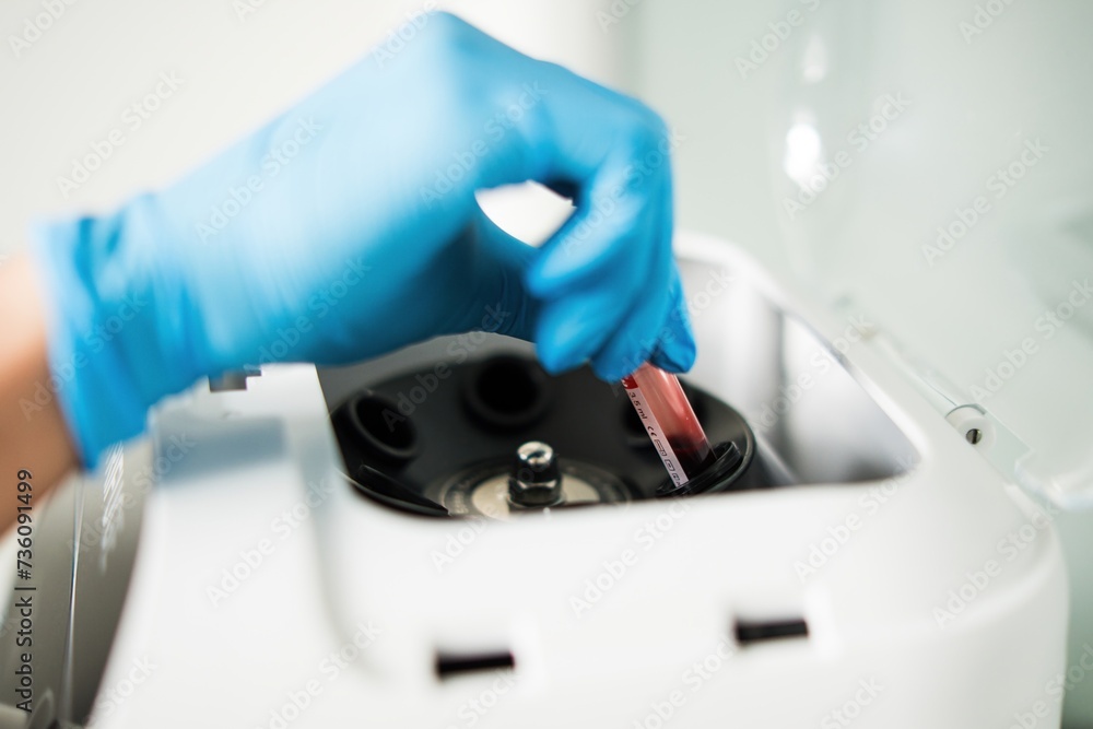 A sample tube with blood tests is placed in a centrifuge with a hand in a blue rubber glove