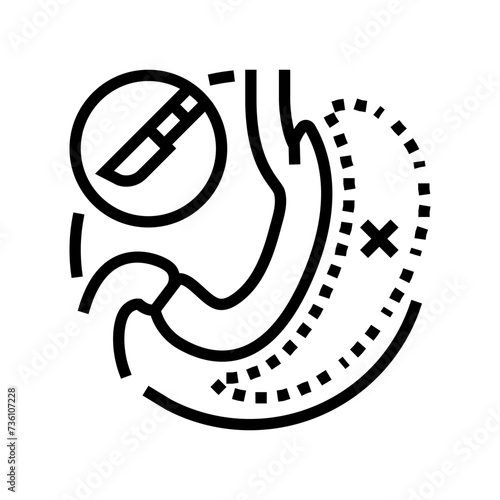 gastrectomy surgery doctor line icon vector. gastrectomy surgery doctor sign. isolated contour symbol black illustration