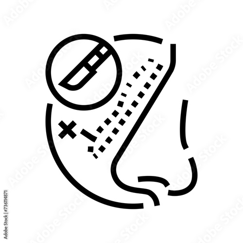 rhinoplasty surgery hospital line icon vector. rhinoplasty surgery hospital sign. isolated contour symbol black illustration