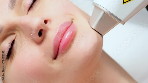 Close-up of a woman's face in a laser hair removal salon. A girl undergoes laser hair removal procedure on her face. Concept of removing unwanted hair. photo