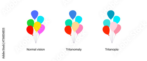 Tritanopia and tritanomaly photo