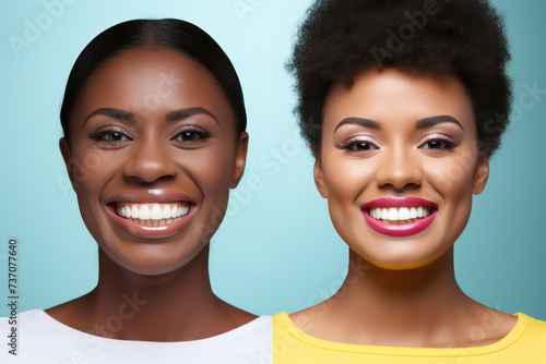 Teeth Whitening In the before picture, a black woman's teeth. Her teeth were visibly whiter.