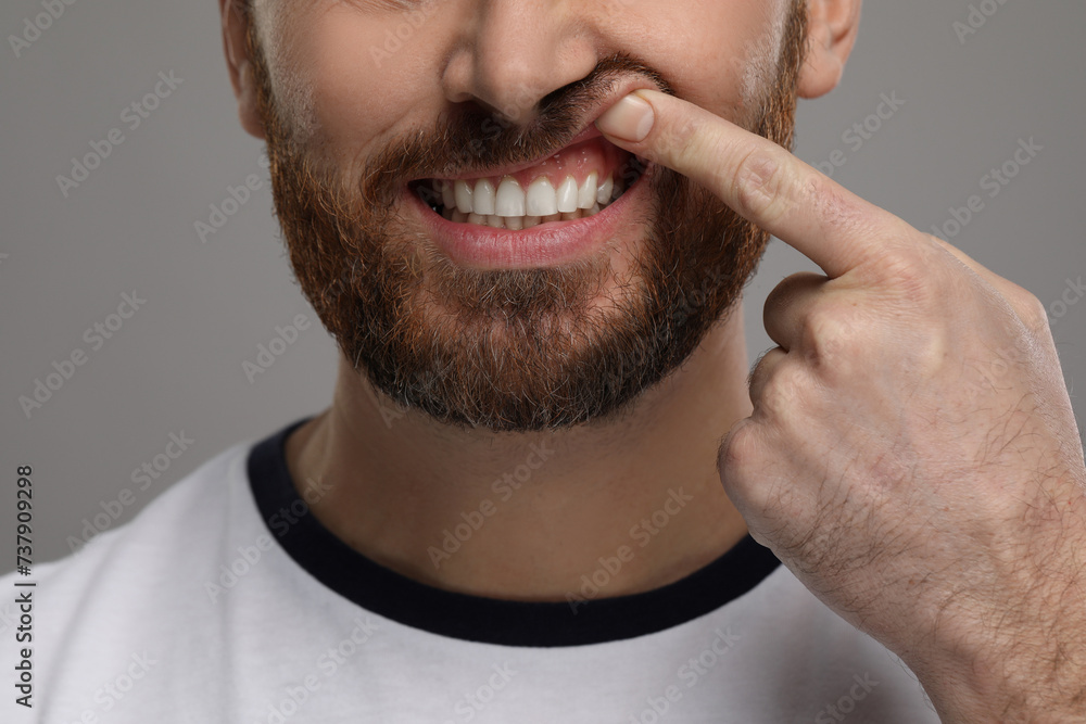 Obraz premium Man showing his healthy teeth and gums on grey background, closeup