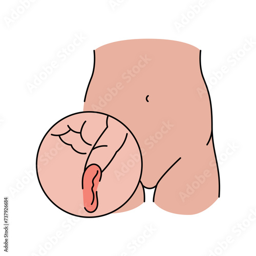 Inguinal hernia line icon. Vector isolated element.