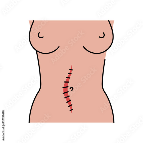 Mildline incision line icon. Abdominal incisions. photo