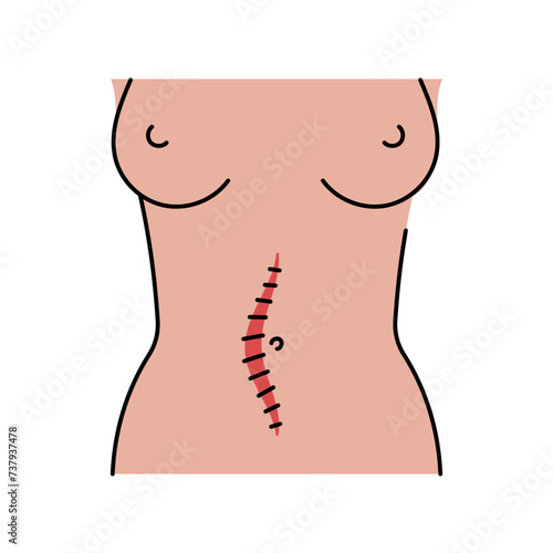 Mildline incision line icon. Abdominal incisions.