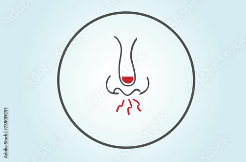 Histamine released by mast cells and basophils during allergic reactions and triggers symptoms such as itching, sneezing, runny nose, and watery eyes.